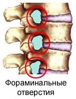 Фораминальные отверстия