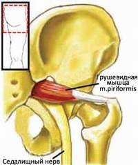   (Musculus Piriformis)